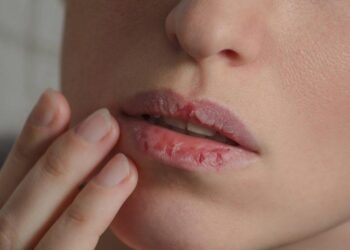 Ağız kuruluğunu hafife almayın… Bu belirtilere dikkat