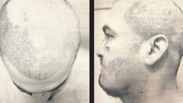 Öğrenci yurdunda sıcak ağdalı işkence!