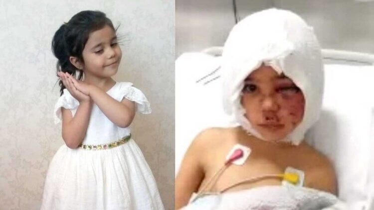 Pitbull saldırısına uğrayan Asiye’den yeni haber!