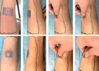 Çinli araştırmacılar yaraların hızlı iyileşmesini sağlayan pansuman tasarladı