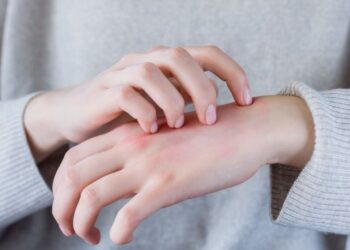 Uzmanlar uyardı: Uyuz vakalarında artış