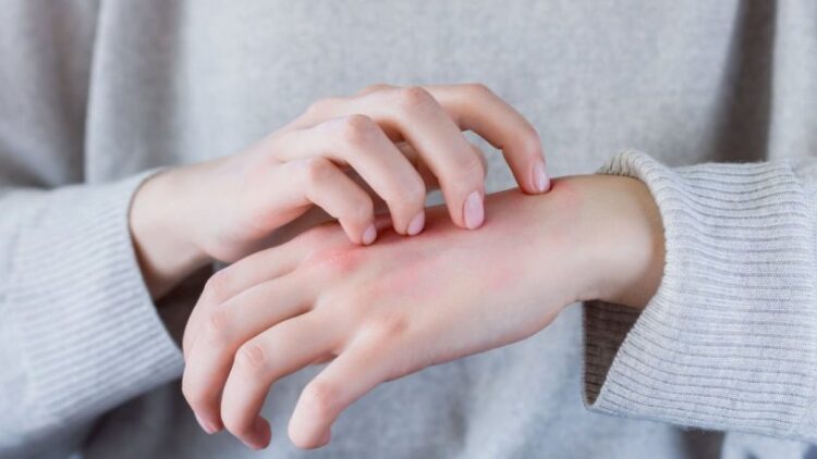 Uzmanlar uyardı: Uyuz vakalarında artış