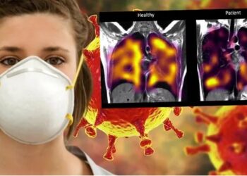 Uzun kovid geçirenler dikkat! Taramalarda ortaya çıkmıyor