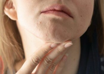 Omicron varyantının ciltteki ‘gizli’ belirtileri paylaşıldı: Mutlaka test yaptırın!