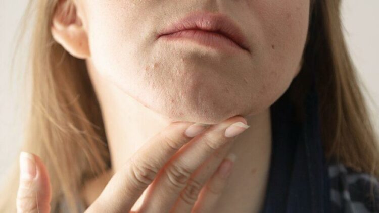 Omicron varyantının ciltteki ‘gizli’ belirtileri paylaşıldı: Mutlaka test yaptırın!