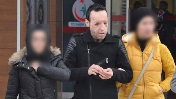 Yüz nakli yapılan Recep Sert, uyuşturucudan gözaltına alındı