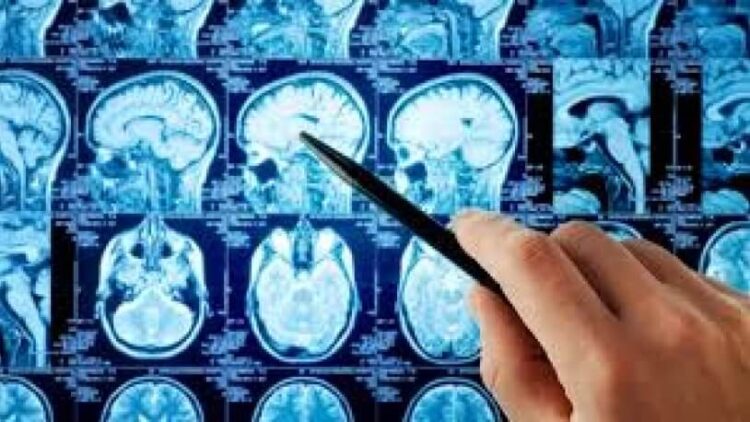 Beyin kanamasını 1 dakikada tespit eden teknoloji Cerrahpaşa’da