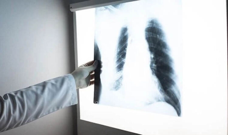 Bilim Kurulu üyesi ‘gizli tehlike’ye karşı uyardı