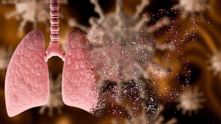 Korkutan uyarı! Covid-19 veremi artırıyor mu?