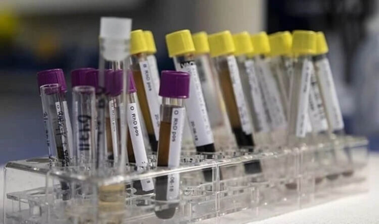 Hepatit virüsü çocukları tehdit ediyor