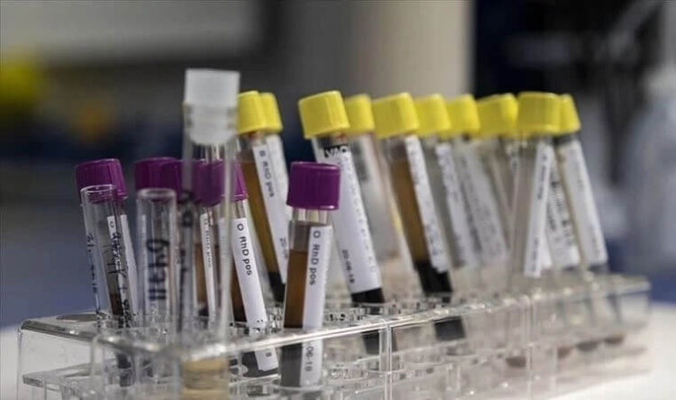 DSÖ’den gizemli hepatit açıklaması