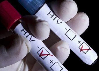 “HIV enfeksiyonunun son 10 yılda yüzde 460 arttığı tek ülke Türkiye”
