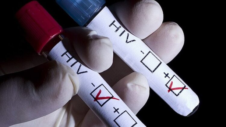 “HIV enfeksiyonunun son 10 yılda yüzde 460 arttığı tek ülke Türkiye”