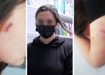 ‘Saçlarımı kestiler, yanağımda sigara söndürdüler’