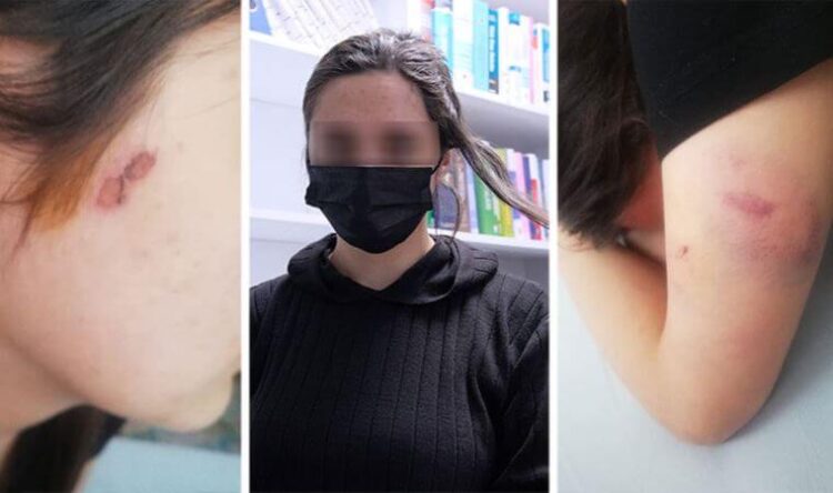 ‘Saçlarımı kestiler, yanağımda sigara söndürdüler’