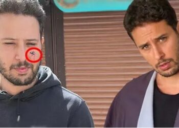 Ünlü oyuncu köpek saldırısına uğradı