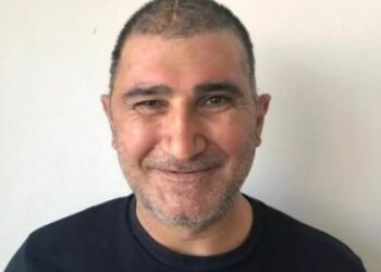 Yüzde 83’ü parçalanan kafatası, titanyumdan yeniden yapıldı