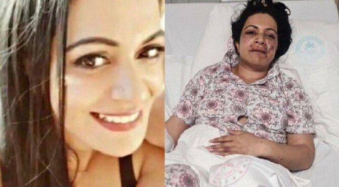 Eltisi tarafından vurulan kadının ağzı parçalandı