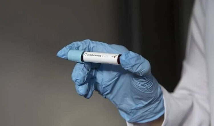 Covid-19’da ikinci perde! Post Covid ne anlama geliyor?