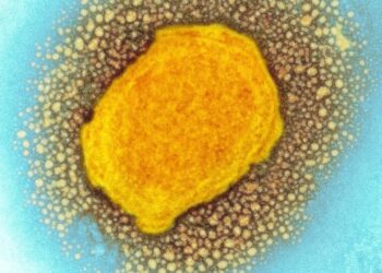 İngiltere’de maymun çiçeği virüsü vakası 20’ye yükseldi