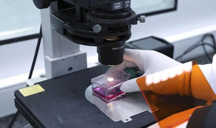 Tarih verdiler: DSÖ’den ‘maymun çiçeği virüsü’ uyarısı