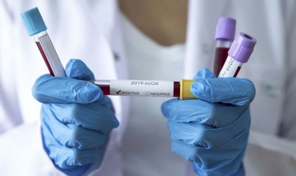 DSÖ iki yeni varyant tespit edildiğini açıkladı