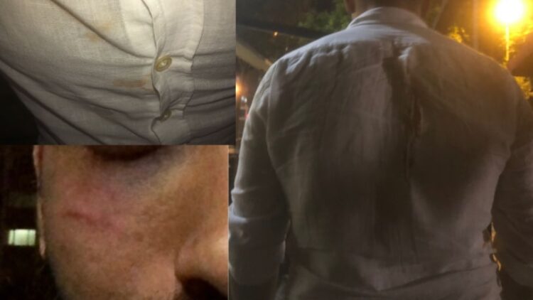 Parkta oturan nişanlı çifte sarıklı ve cübbeli kişiler saldırdı