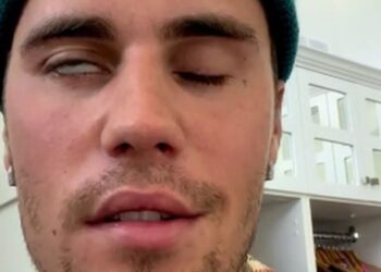 Justin Bieber’ın yakalandığı Ramsay Hunt sendromu nedir?