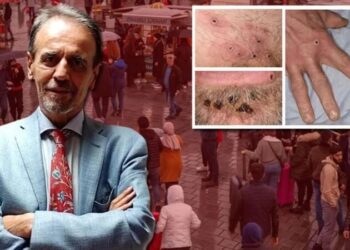 İlk vaka tespit edildi, şimdi ne olacak? Ceyhan uyardı: Bu üç semptoma dikkat edin!