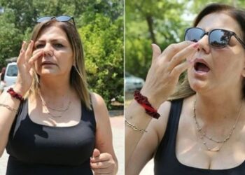 Estetik faciası: Burun kemiklerim genzimden düştü