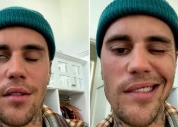 Justin Bieber, yüz felci geçirdi