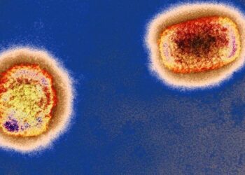 DSÖ: Dünya çapında maymun çiçeği vakası sayısı 3 bin 400’ü aştı