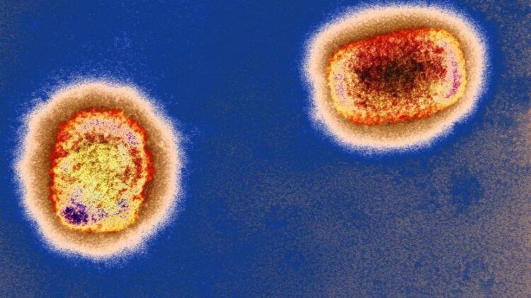 DSÖ: Dünya çapında maymun çiçeği vakası sayısı 3 bin 400’ü aştı