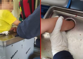 4 yaşındaki çocuk elini kıyma makinesine kaptırdı