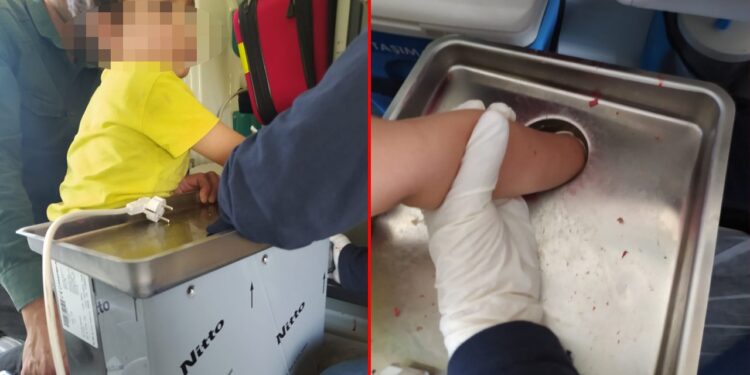 4 yaşındaki çocuk elini kıyma makinesine kaptırdı