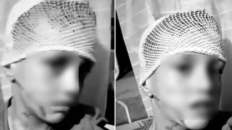 Suriyeliler, 20 lira vermeyen çocuğun yüzüne kezzap attı iddiası