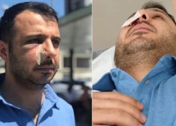 Adres bu kez İstanbul: Hastanede sağlık çalışanına saldırı