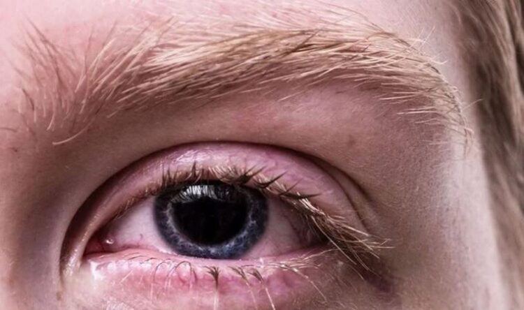 Koronavirüs geçirenlerde göz sağlığı da bozuluyor