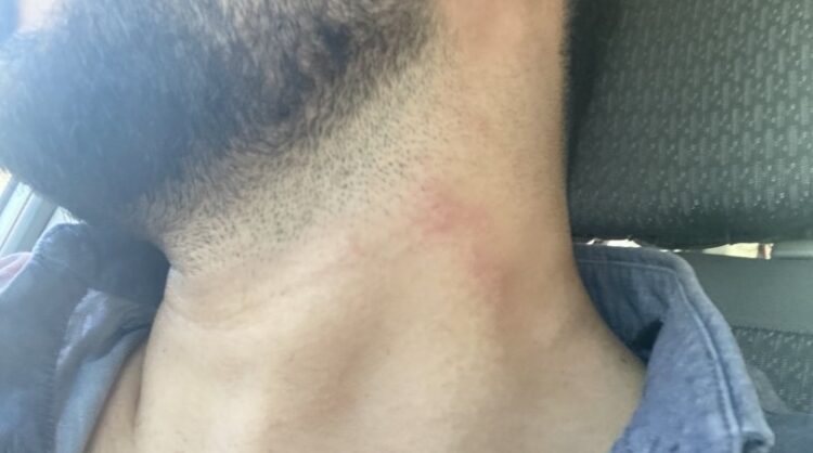 Adana’da haber takip eden gazetecileri darp ettiler