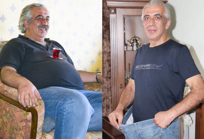 Kalp krizinden korkup 60 kilo verdi, hayatını kaybetti