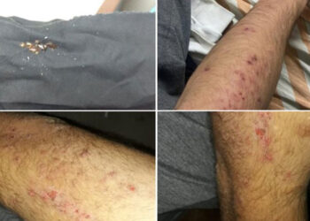 İşçiler tahtakurulu yataklarda kalıyor!