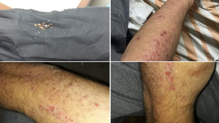 İşçiler tahtakurulu yataklarda kalıyor!