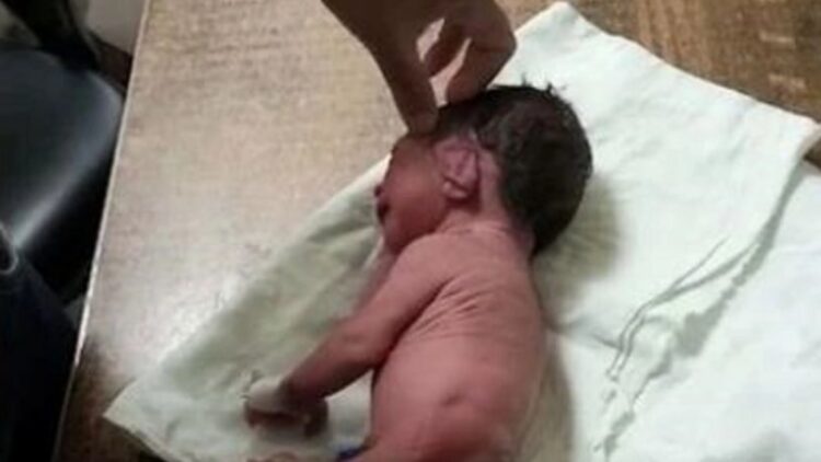 Doktorlar ayak yerine boynuzla doğan bebeği görünce şaşkına döndü