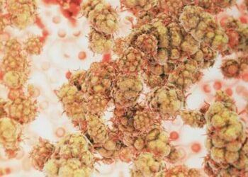 Maymun çiçeğinin yeni belirtisi ortaya çıktı!