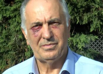 Saldırıya uğrayan cemevi başkanı: “Küfür ederek yumruk atmaya başladılar”