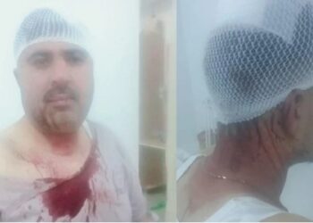 Muhtardan sendika başkanına dayak