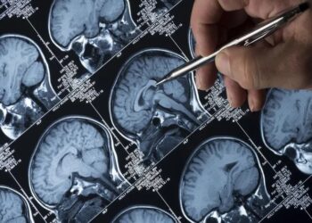 Beyin taramasından düşünceleri ‘okuyan’ bir yazılım geliştiriliyor