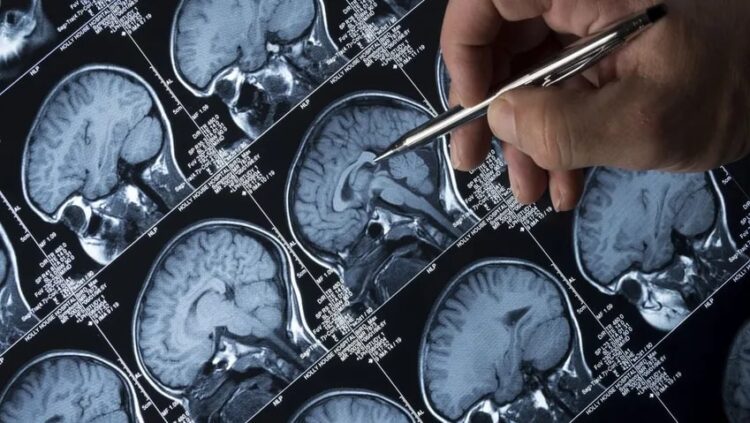 Beyin taramasından düşünceleri ‘okuyan’ bir yazılım geliştiriliyor