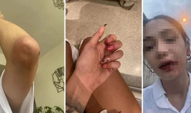 İstanbul’da kız kardeşlere sokak ortasında saldırı