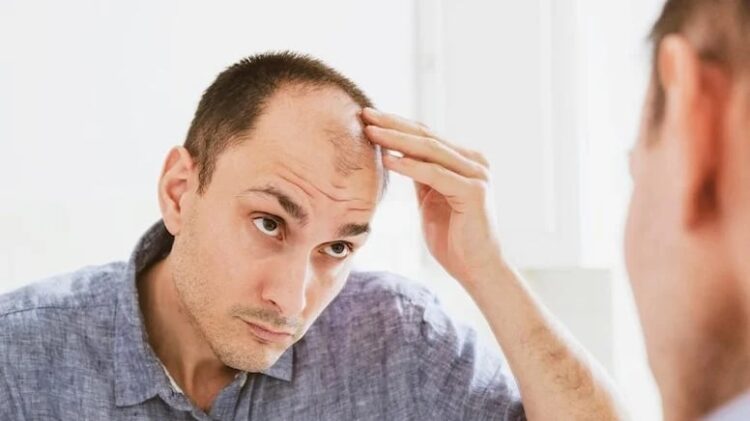 Müthiş keşif… Kelliğin sonu geliyor